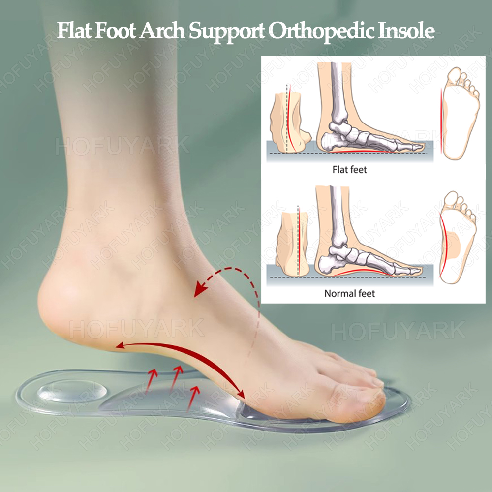 Silicone Gel Insoles Orthopedi - Women'S Shoes With Plantar Fasciitis 评论和价格